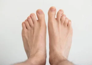 Nahaseene plaaster photo review